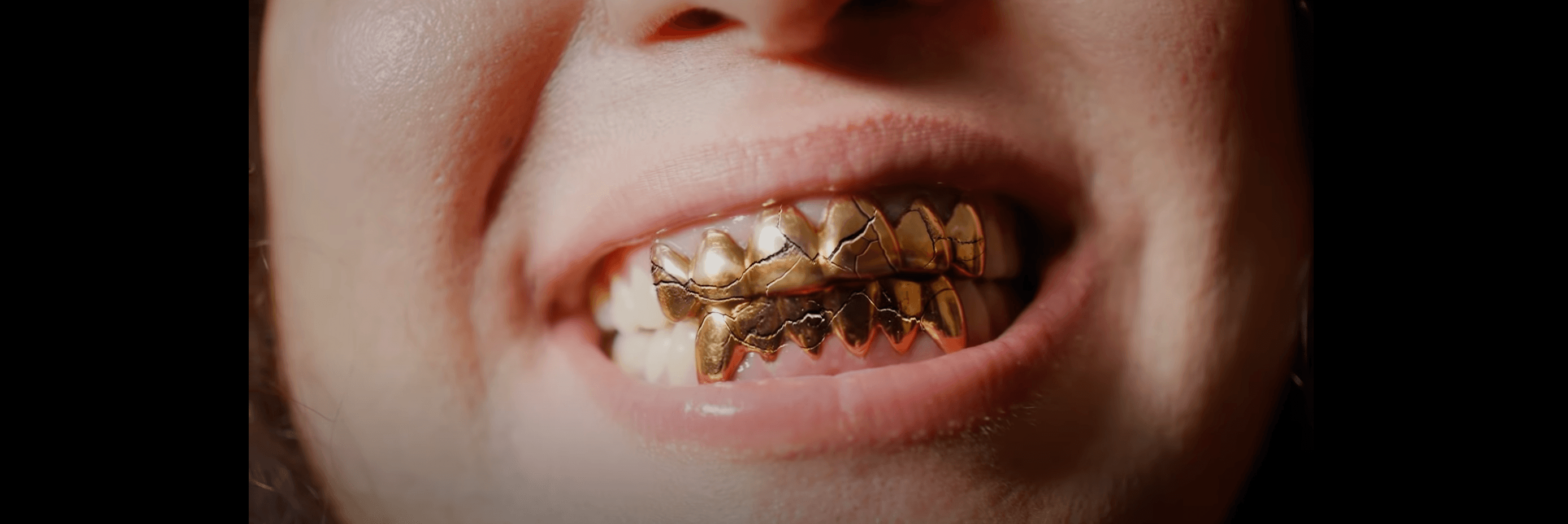 Video title